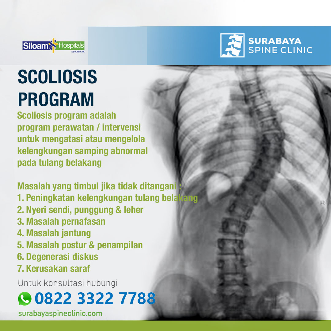 Scoliosis Program 